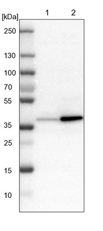 GALE Antibody in Western Blot (WB)
