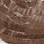 cGKII Polyclonal Antibody