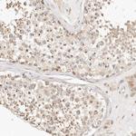 FAM20B Antibody in Immunohistochemistry (Paraffin) (IHC (P))