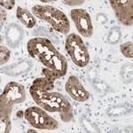 CDK3 Antibody in Immunohistochemistry (Paraffin) (IHC (P))