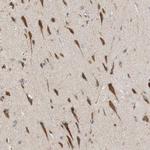 FAAH Antibody in Immunohistochemistry (Paraffin) (IHC (P))