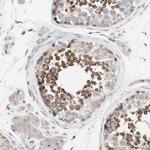 FAAH Antibody in Immunohistochemistry (IHC)