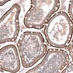 TSPAN13 Antibody in Immunohistochemistry (IHC)