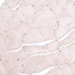 TSPAN13 Antibody in Immunohistochemistry (IHC)