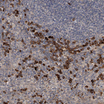 SPOCK1 Antibody in Immunohistochemistry (Paraffin) (IHC (P))