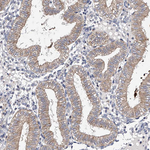 SPOCK1 Antibody in Immunohistochemistry (Paraffin) (IHC (P))
