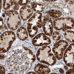 SPOCK1 Antibody in Immunohistochemistry (Paraffin) (IHC (P))