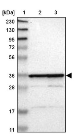 MRPL2 Antibody in Western Blot (WB)