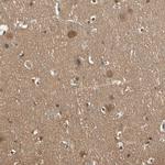 PNCK Antibody in Immunohistochemistry (Paraffin) (IHC (P))