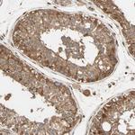 PNCK Antibody in Immunohistochemistry (Paraffin) (IHC (P))