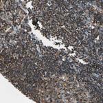 CAPZA2 Polyclonal Antibody