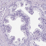 SGCG Antibody in Immunohistochemistry (Paraffin) (IHC (P))