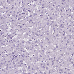SGCG Antibody in Immunohistochemistry (Paraffin) (IHC (P))