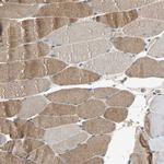 XYLT1 Polyclonal Antibody