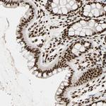 ILF2 Antibody in Immunohistochemistry (Paraffin) (IHC (P))