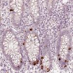 NPSR1 Polyclonal Antibody