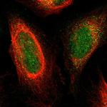 Plexin-A1 Polyclonal Antibody