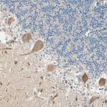 Plexin-A1 Antibody in Immunohistochemistry (Paraffin) (IHC (P))
