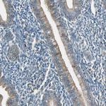Plexin-A1 Antibody in Immunohistochemistry (Paraffin) (IHC (P))