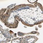 Plexin-A1 Antibody in Immunohistochemistry (Paraffin) (IHC (P))