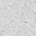 Plexin-A1 Antibody in Immunohistochemistry (Paraffin) (IHC (P))