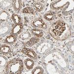 GALNT10 Polyclonal Antibody