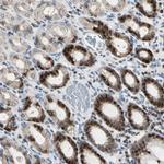 IP6K2 Antibody in Immunohistochemistry (IHC)
