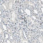 IP6K2 Antibody in Immunohistochemistry (IHC)