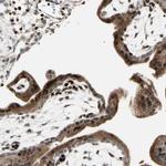 IP6K2 Antibody in Immunohistochemistry (IHC)