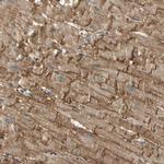 Alpha Sarcoglycan Polyclonal Antibody