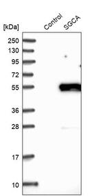 Alpha Sarcoglycan Antibody in Western Blot (WB)
