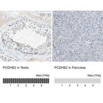 PCDHB2 Antibody in Immunohistochemistry (IHC)