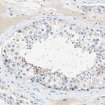 PCDHB2 Antibody in Immunohistochemistry (IHC)