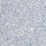 PCDHB2 Antibody in Immunohistochemistry (IHC)