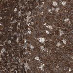 CRLF3 Antibody in Immunohistochemistry (Paraffin) (IHC (P))