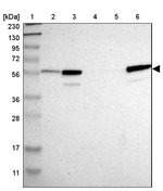CRLF3 Antibody in Western Blot (WB)