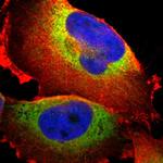 P4HA1 Polyclonal Antibody