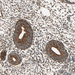 P4HA1 Antibody in Immunohistochemistry (IHC)