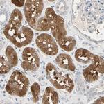 BBOX1 Antibody in Immunohistochemistry (Paraffin) (IHC (P))