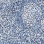 BBOX1 Antibody in Immunohistochemistry (Paraffin) (IHC (P))