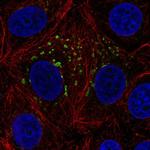 MGAT4A Polyclonal Antibody