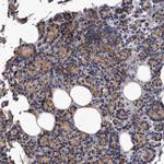 MGAT4A Antibody in Immunohistochemistry (IHC)