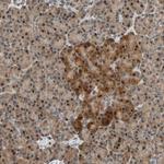 HECW1 Polyclonal Antibody