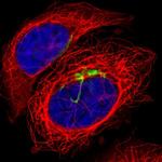 GALNT3 Polyclonal Antibody