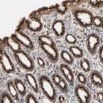 GALNT3 Antibody in Immunohistochemistry (Paraffin) (IHC (P))