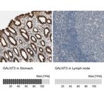 GALNT3 Antibody in Immunohistochemistry (IHC)