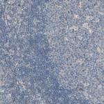 GALNT3 Antibody in Immunohistochemistry (IHC)