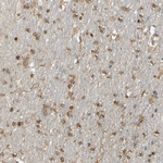 MEKK4 Antibody in Immunohistochemistry (Paraffin) (IHC (P))