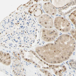 MEKK4 Antibody in Immunohistochemistry (Paraffin) (IHC (P))