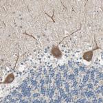 MLK4 Antibody in Immunohistochemistry (Paraffin) (IHC (P))